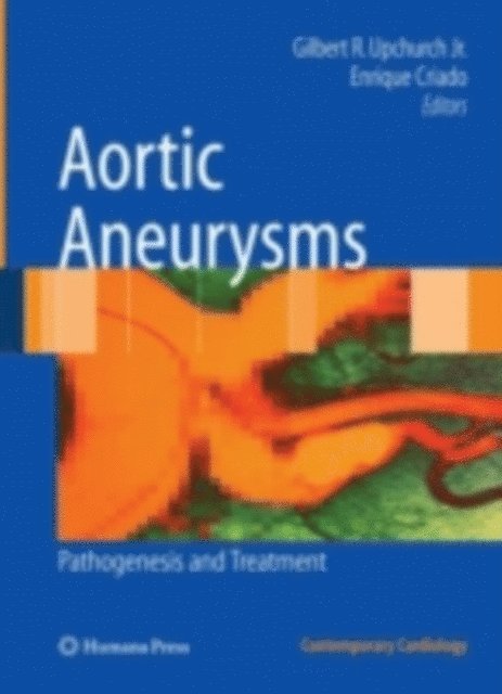 Enrique Criado, Gilbert R. Upchurch Jr. - Aortic Aneurysms, E-bok
