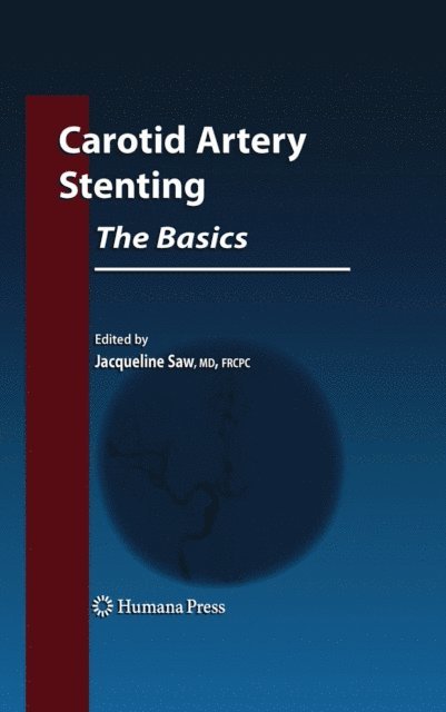 Jacqueline Saw - Carotid Artery Stenting: The Basics, E-bok