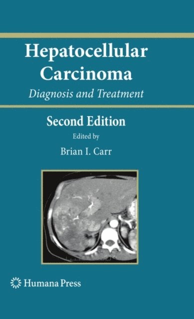 Brian I. Carr - Hepatocellular Carcinoma, E-bok