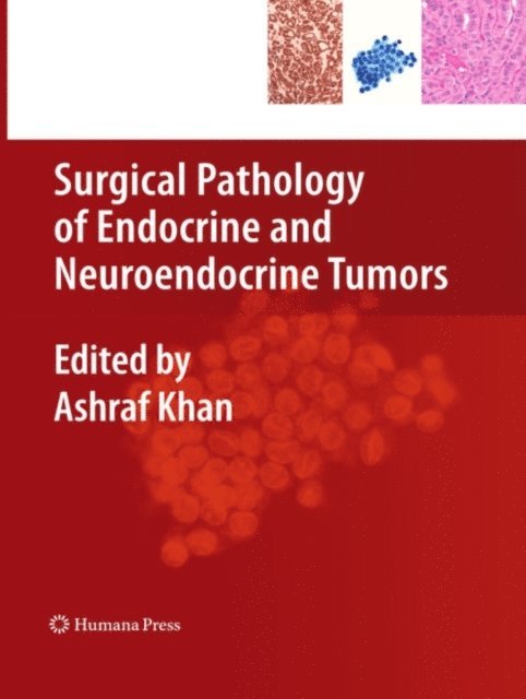 Ashraf Khan - Surgical Pathology of Endocrine and Neuroendocrine Tumors, E-bok