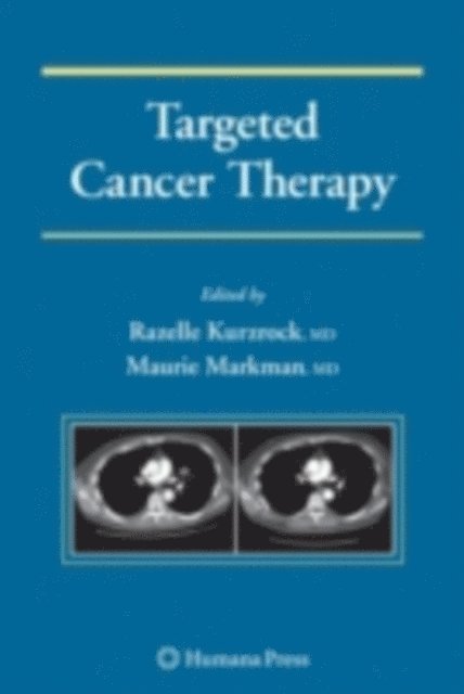 Maurie Markman, Razelle Kurzrock - Targeted Cancer Therapy, E-bok