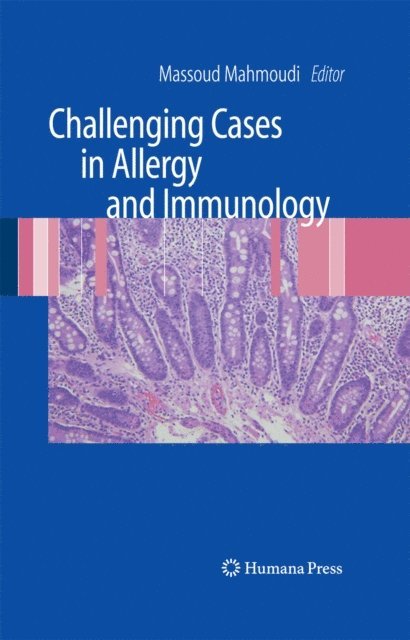 Massoud Mahmoudi - Challenging Cases in Allergy and Immunology, E-bok. Tillgänglighet: Lägg i varukorg
