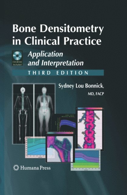 Sydney Lou Bonnick - Bone Densitometry in Clinical Practice, E-bok