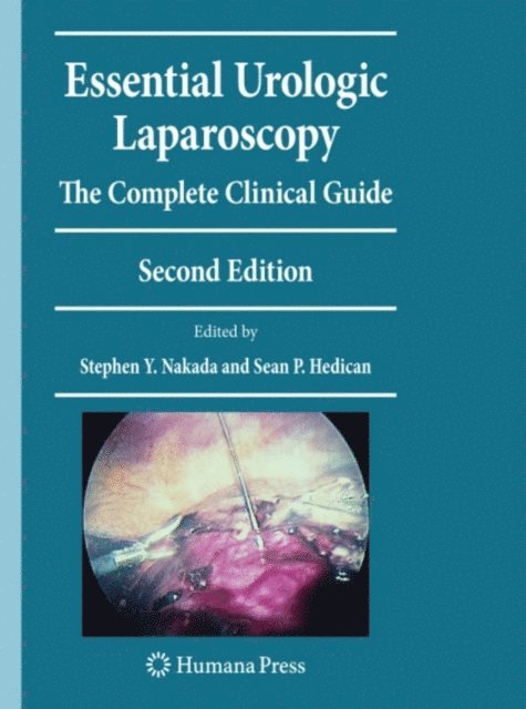 Sean Hedican, Stephen Y. Nakada - Essential Urologic Laparoscopy, E-bok