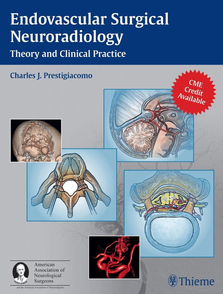 Charles J. Prestigiacomo - Endovascular Surgical Neuroradiology, Inbunden. Tillgänglighet: Lägg i varukorg