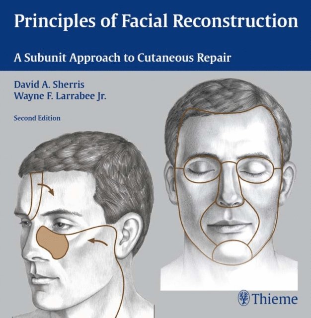 Wayne F. Larrabee, David A. Sherris - Principles of Facial Reconstruction, E-bok