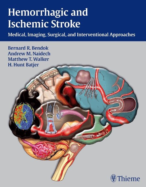 Bernard Bendok, Andrew M. Naidech, Matthew T Walker, H. Hunt Batjer - Hemorrhagic and Ischemic Stroke, Inbunden. Tillgänglighet: Tillfälligt slut