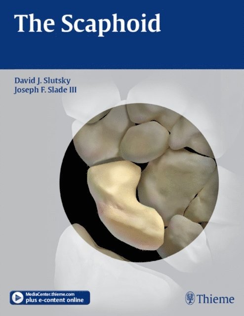III Joseph F Slade, David J. Slutsky - Scaphoid, E-bok. Tillgänglighet: Lägg i varukorg