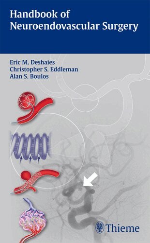 Eric M. Deshaies, Christopher S. Eddleman, Alan S. Boulos - Handbook of Neuroendovascular Surgery, Häftad. Tillgänglighet: Tillfälligt slut