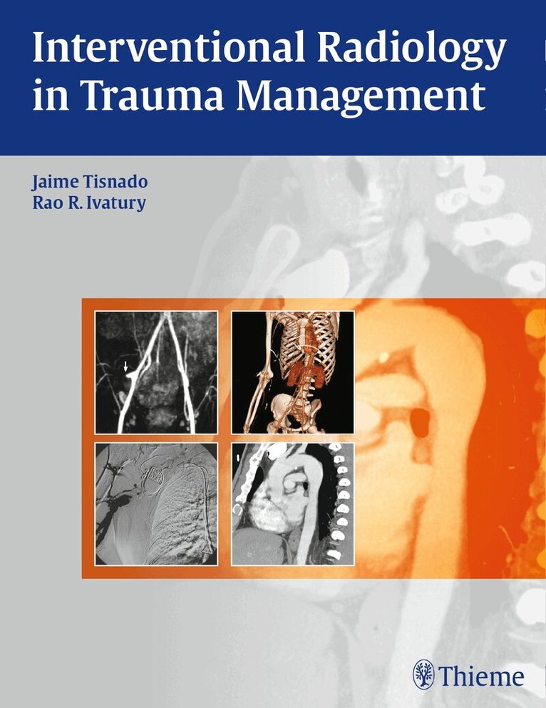 Jaime Tisnado, Rao R Ivatury - Interventional Radiology in Trauma, Inbunden