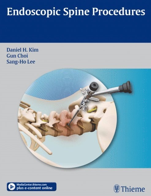 Sang-Ho Lee, Gun Choi, Daniel H. Kim - Endoscopic Spine Procedures, E-bok