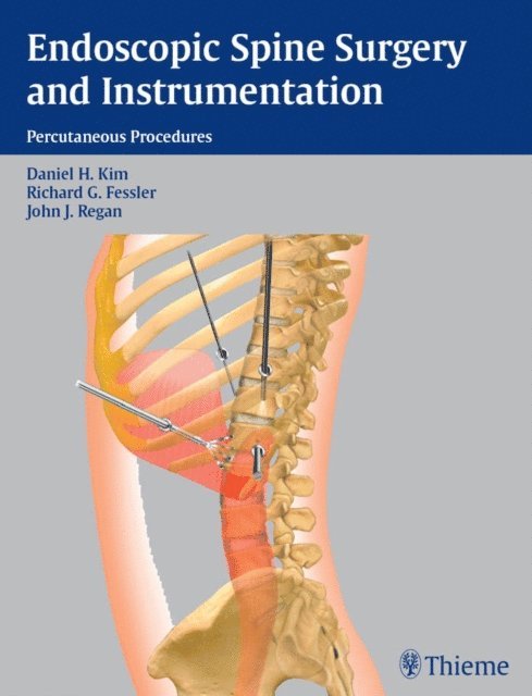 John J. Regan, Richard G. Fessler, Daniel H. Kim - Endoscopic Spine Surgery and Instrumentation, E-bok