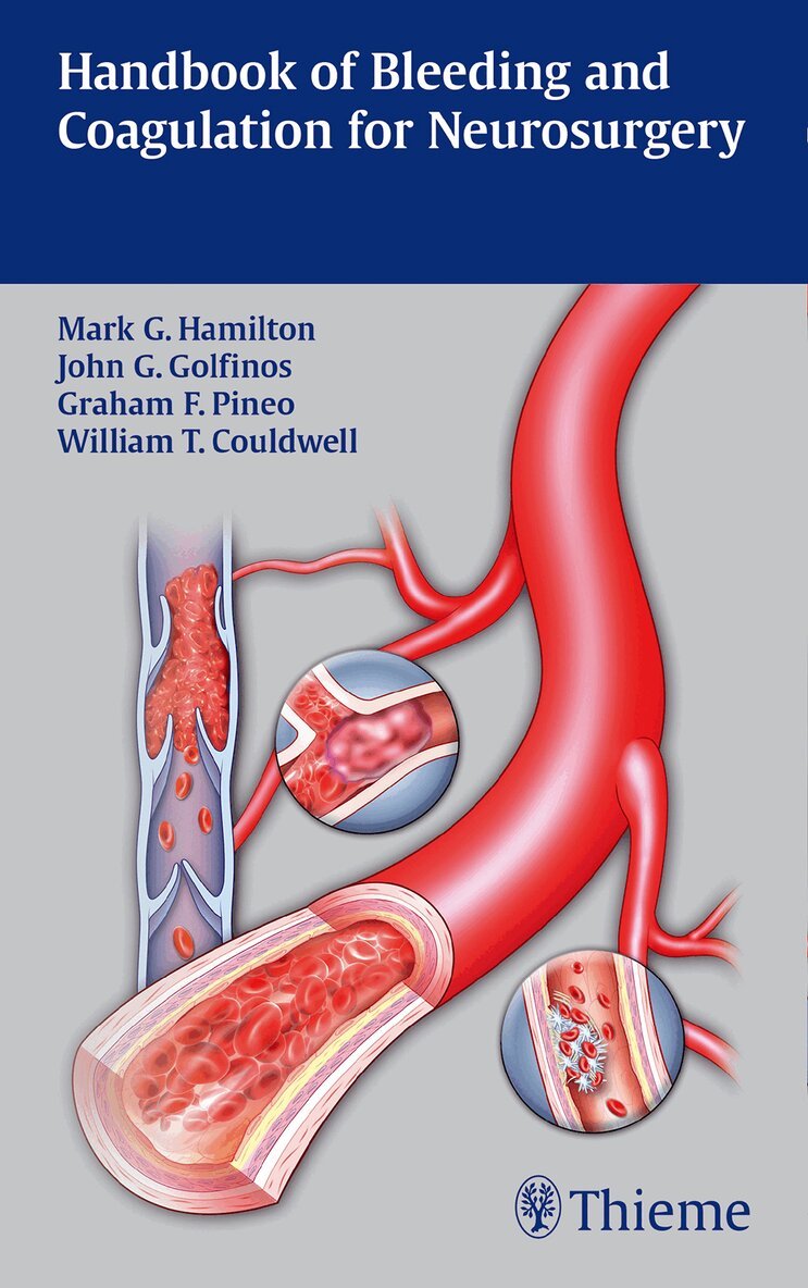 Mark G. Hamilton, John G. Golfinos, Graham Pineo, William T. Couldwell - Handbook of Bleeding and Coagulation for Neurosurgery, Häftad. Tillgänglighet: Tillfälligt slut