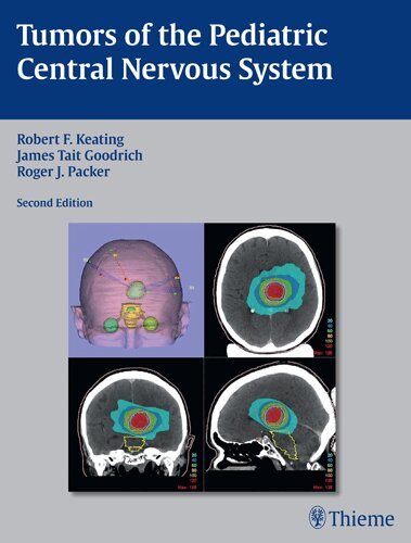 Robert F Keating, James Tait Goodrich, Roger Packer - Tumors of the Pediatric Central Nervous System, Inbunden