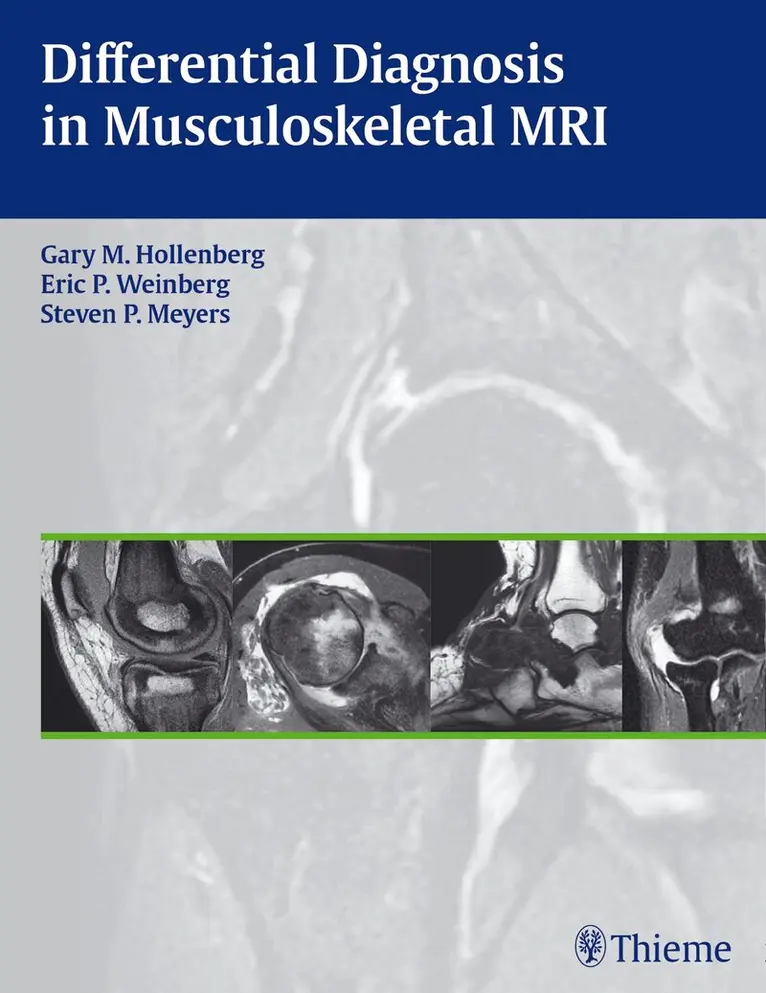 Gary M. Hollenberg, Eric P. Weinberg, Steven P. Meyers - Differential Diagnosis in Musculoskeletal MR, Inbunden. Tillgänglighet: Lägg i varukorg