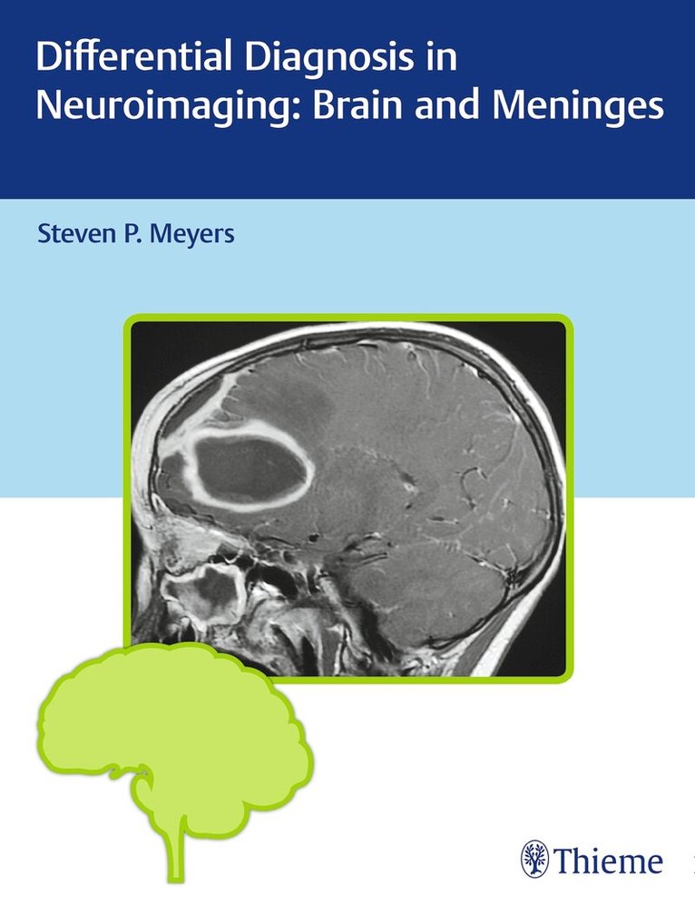 Steven P. Meyers - Differential Diagnosis in Neuroimaging: Brain and Meninges, Inbunden. Tillgänglighet: Lägg i varukorg