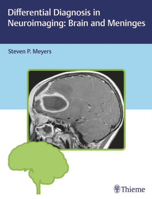 Steven P. Meyers - Differential Diagnosis in Neuroimaging: Brain and Meninges, E-bok. Tillgänglighet: Lägg i varukorg