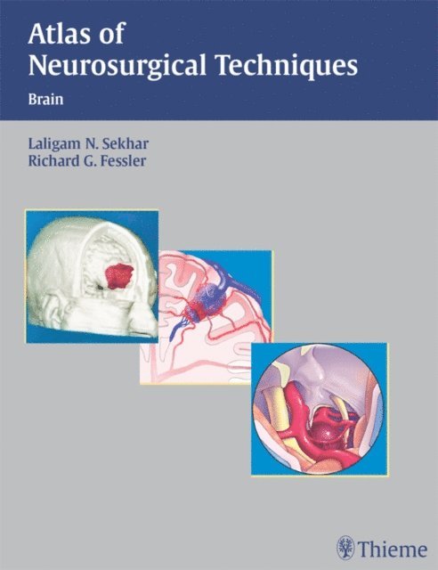 Richard Glenn Fessler, Laligam N. Sekhar - Atlas of Neurosurgical Techniques, E-bok