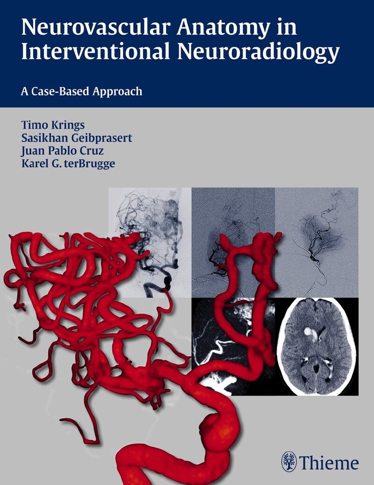 Timo Krings, Sasikhan Geibprasert, Juan Pablo Cruz, Karel ter Brugge - Neurovascular Anatomy in Interventional Neuroradiology, Häftad