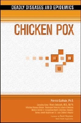 Patrick G. Guilfoile - Chicken Pox, Inbunden. Tillgänglighet: Tillfälligt slut