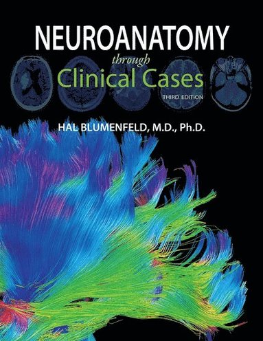 Neuroanatomy through Clinical Cases av Hal Blumenfeld