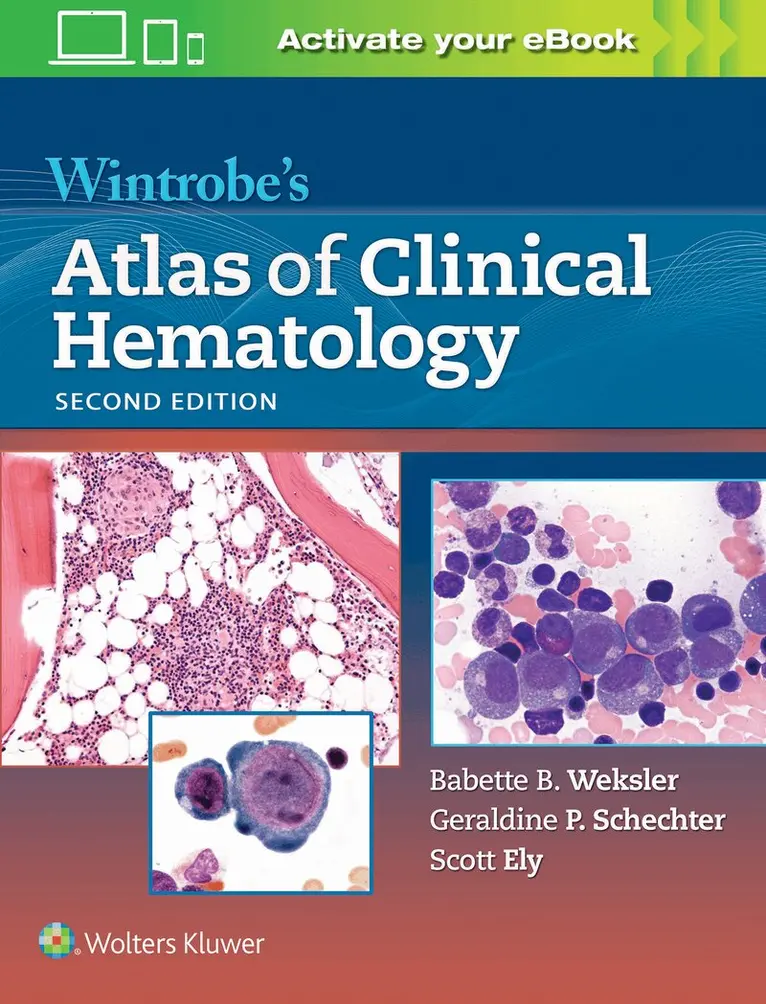 Babette Weksler, Geraldine P Schechter, Scott Ely - Wintrobe's Atlas of Clinical Hematology, Inbunden. Tillgänglighet: Tillfälligt slut
