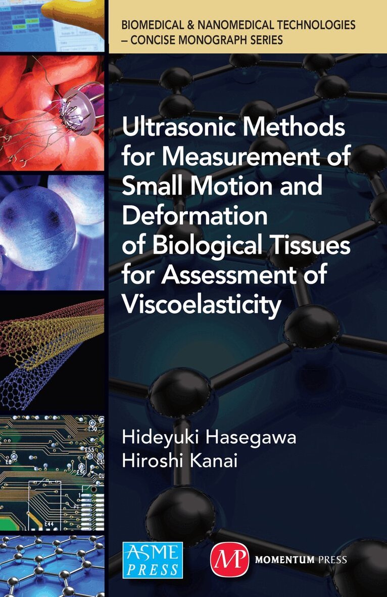 Hideyuki Hasegawa, Hiroshi Kanai - Ultrasonic Methods for Measurement of Small Motion and Deformation of Biological Tissues for Assessment of Viscoelasticity, Inbunden. Tillgänglighet: Tillfälligt slut