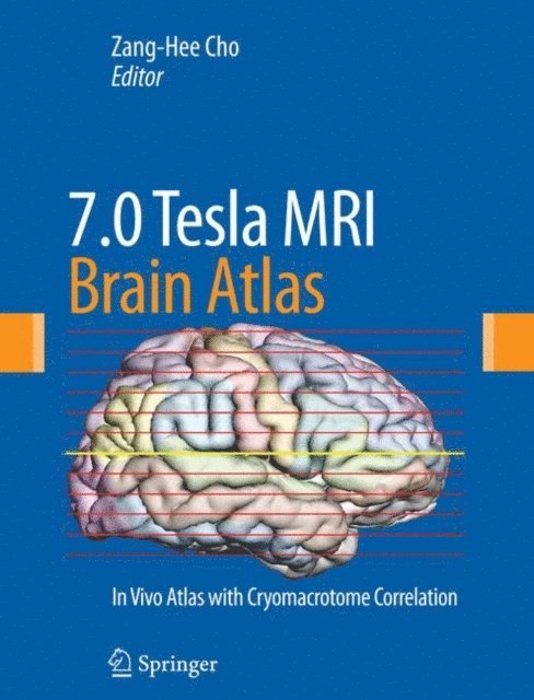 Zang-Hee Cho - 7.0 Tesla MRI Brain Atlas, E-bok