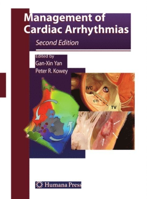 Peter R. Kowey, Gan-Xin Yan - Management of Cardiac Arrhythmias, E-bok