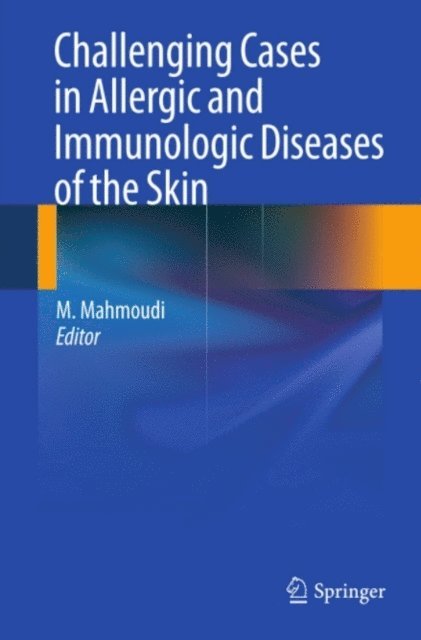 Massoud Mahmoudi - Challenging Cases in Allergic and Immunologic Diseases of the Skin, E-bok. Tillgänglighet: Lägg i varukorg
