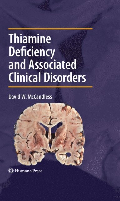 David W. McCandless - Thiamine Deficiency and Associated Clinical Disorders, E-bok