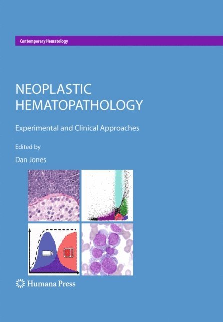 Dan Jones - Neoplastic Hematopathology, E-bok