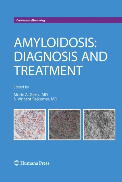 S. Vincent Rajkumar, Morie A. Gertz - Amyloidosis, E-bok
