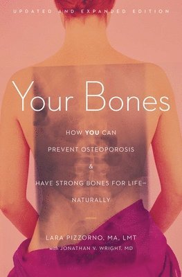 Lara Pizzorno - Your Bones: How You Can Prevent Osteoporosis and Have Strong Bones for Life--Naturally, Häftad