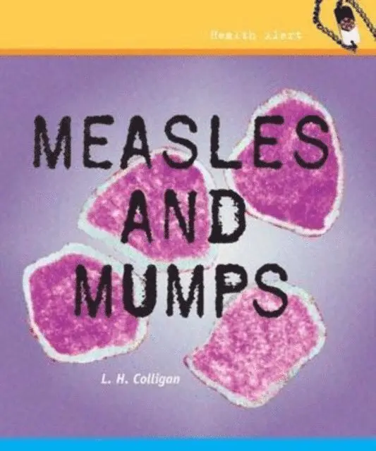 L. H. Colligan - Measles and Mumps, E-bok. Tillgänglighet: Lägg i varukorg