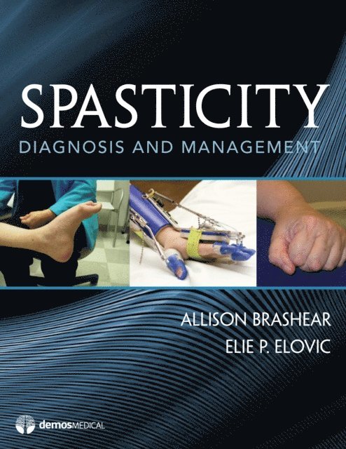 MD Allison Brashear - Spasticity, E-bok. Tillgänglighet: Lägg i varukorg