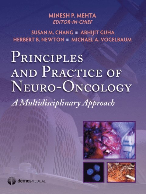 Principles & Practice of Neuro-Oncology, E-bok