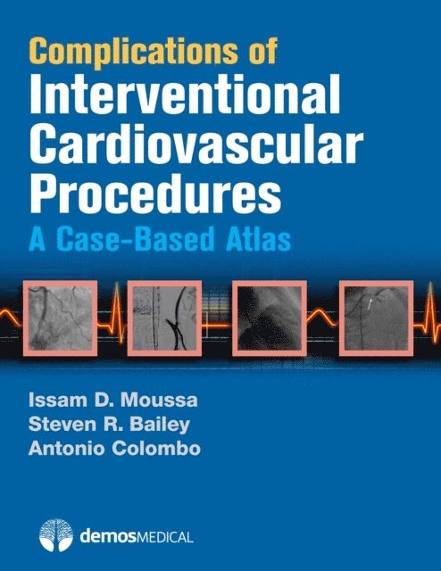 MD Issam D. Moussa, MD Antonio Colombo, MD Steven R. Bailey - Complications of Interventional Cardiovascular Procedures, E-bok