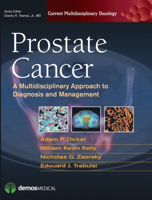 MD Nicholas G. Zaorsky, MD Edouard J. Trabulsi, DO William Kevin Kelly, PhD Adam P. Dicker, MD - Prostate Cancer, E-bok