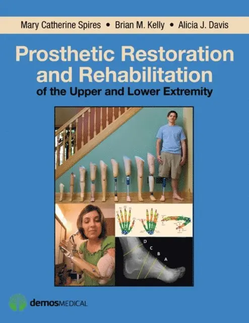 Prosthetic Restoration and Rehabilitation of the Upper and Lower Extremity