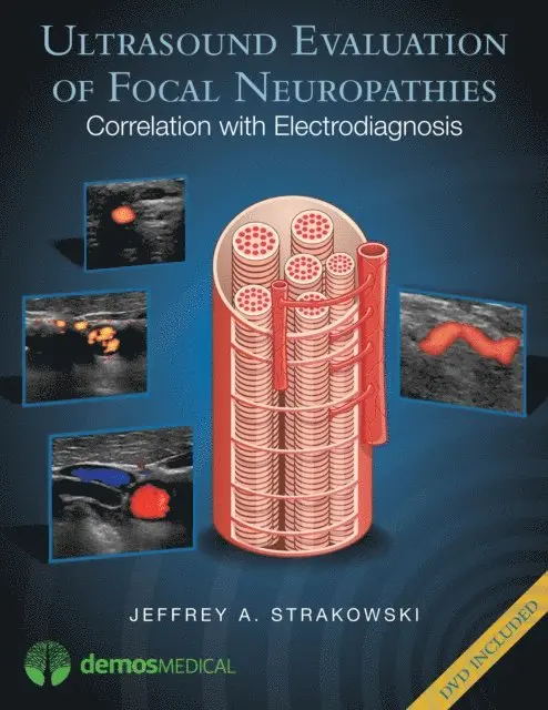 MD Jeffrey A. Strakowski - Ultrasound Evaluation of Focal Neuropathies, E-bok. Tillgänglighet: Lägg i varukorg