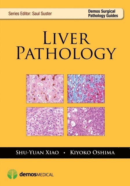 Shu-Yuan Xiao, MD Kiyoko Oshima - Liver Pathology, E-bok. Tillgänglighet: Lägg i varukorg