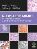 Neoplastic Mimics in Thoracic and Cardiovascular Pathology