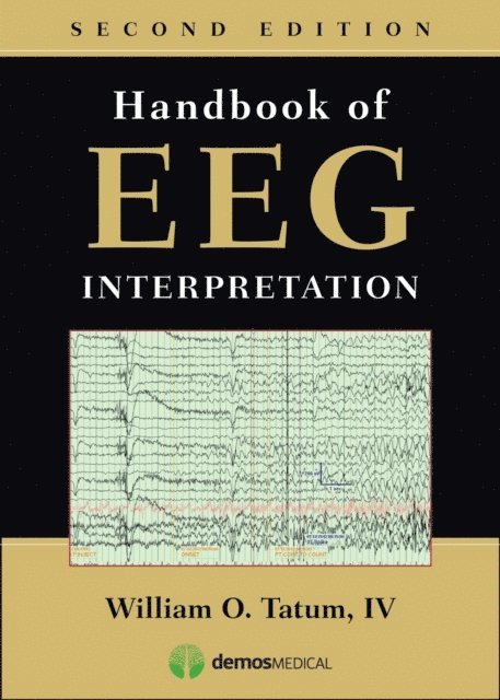 DO William O. Tatum, IV - Handbook of EEG Interpretation, E-bok