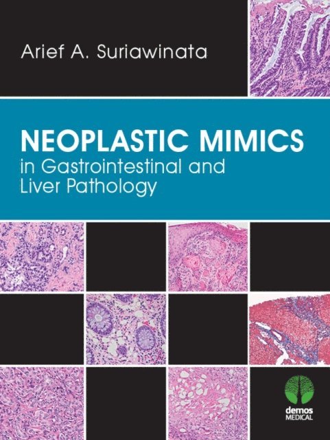 MD Arief A Suriawinata - Neoplastic Mimics in Gastrointestinal and Liver Pathology, E-bok. Tillgänglighet: Lägg i varukorg