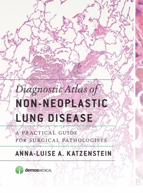MD Anna-Luise A. Katzenstein - Diagnostic Atlas of Non-Neoplastic Lung Disease, E-bok