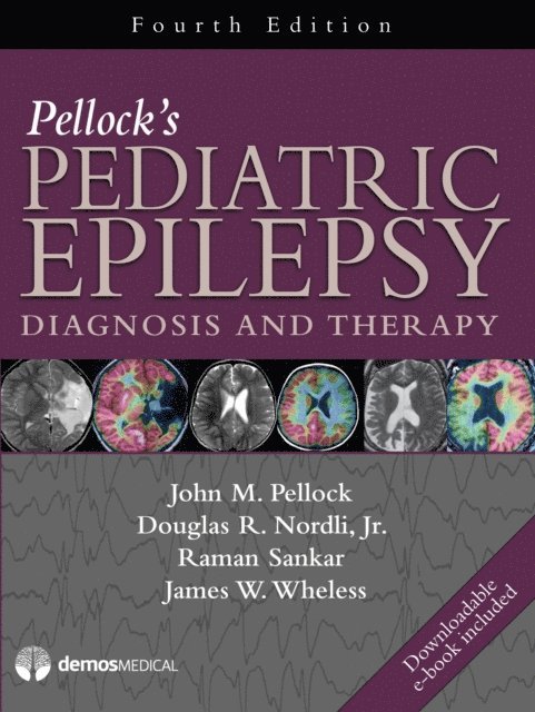 MD James W. Wheless, PhD Raman Sankar, MD, MD John M. Pellock, MD Douglas R. Nordli, Jr. - Pellock's Pediatric Epilepsy, E-bok