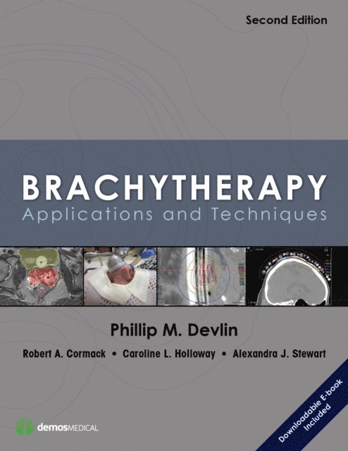 FACR Phillip M. Devlin, MD - Brachytherapy, E-bok