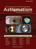Complete Surgical Guide for Correcting Astigmatism