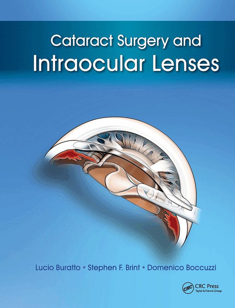 Lucio Buratto, Stephen Brint, Domenico Boccuzzi - Cataract Surgery and Intraocular Lenses, Inbunden. Tillgänglighet: Lägg i varukorg